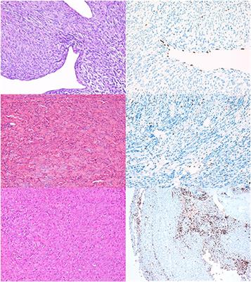 Loss of H3K27me3 expression in canine nerve sheath tumors